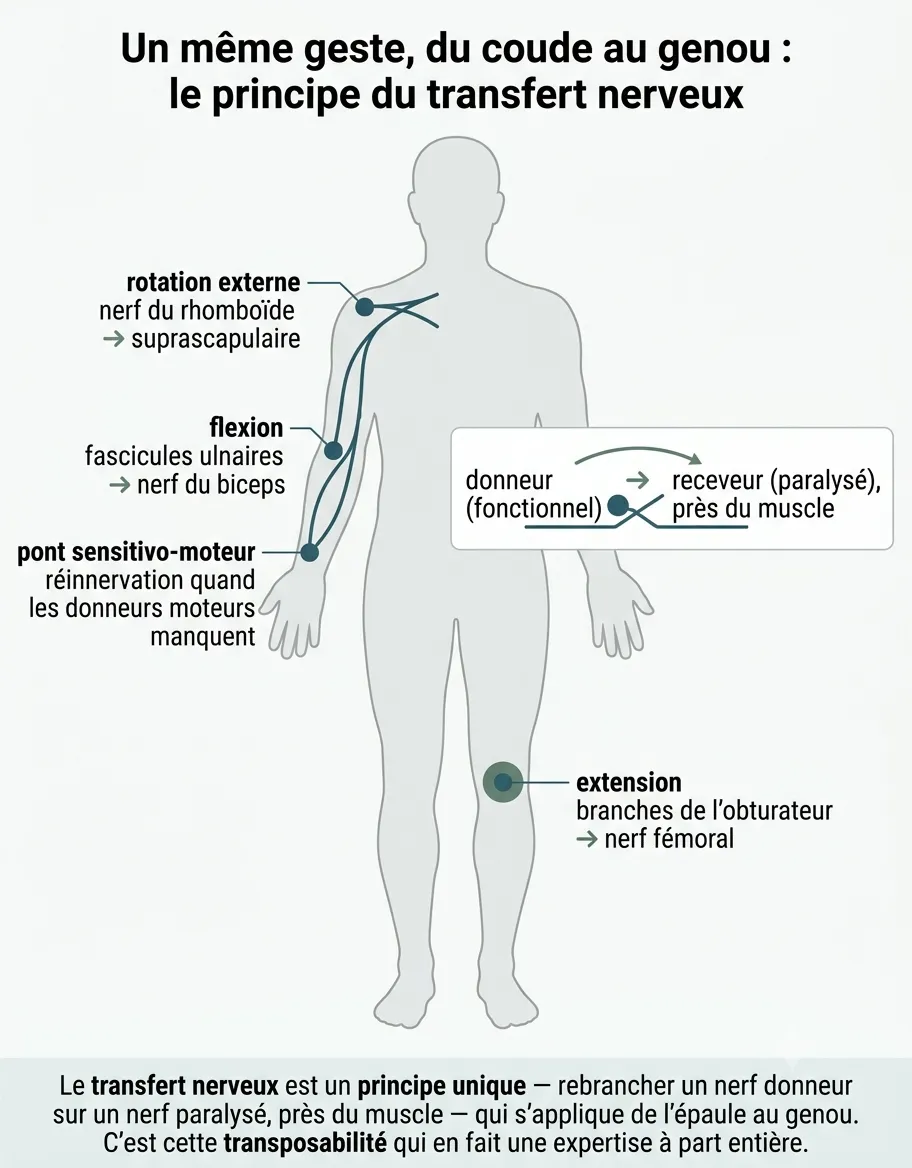 Les transferts nerveux — illustration médicale