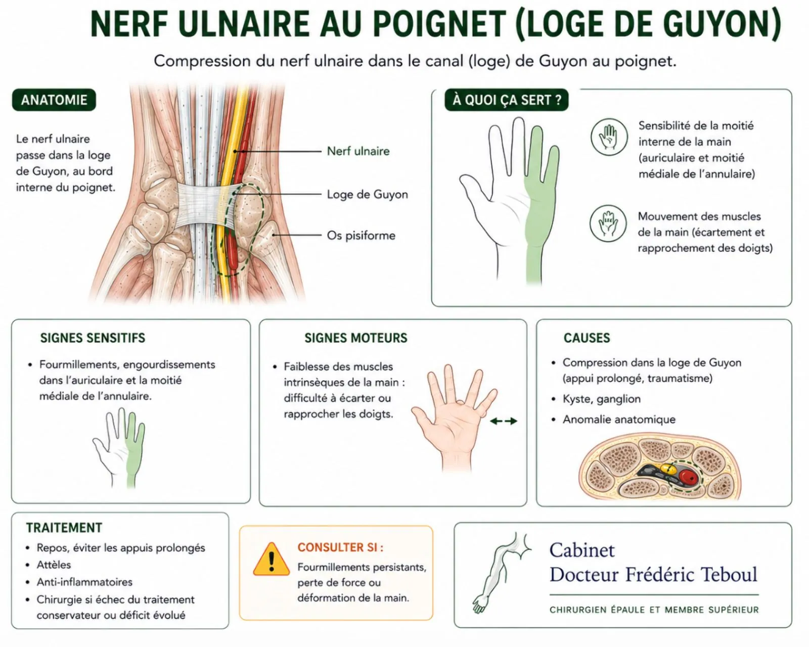 Compression du nerf ulnaire au poignet dans la loge de Guyon : anatomie, territoire sensitif, signes moteurs, causes et traitements — Dr Frédéric Teboul, chirurgien spécialiste de la main et des nerfs à Paris