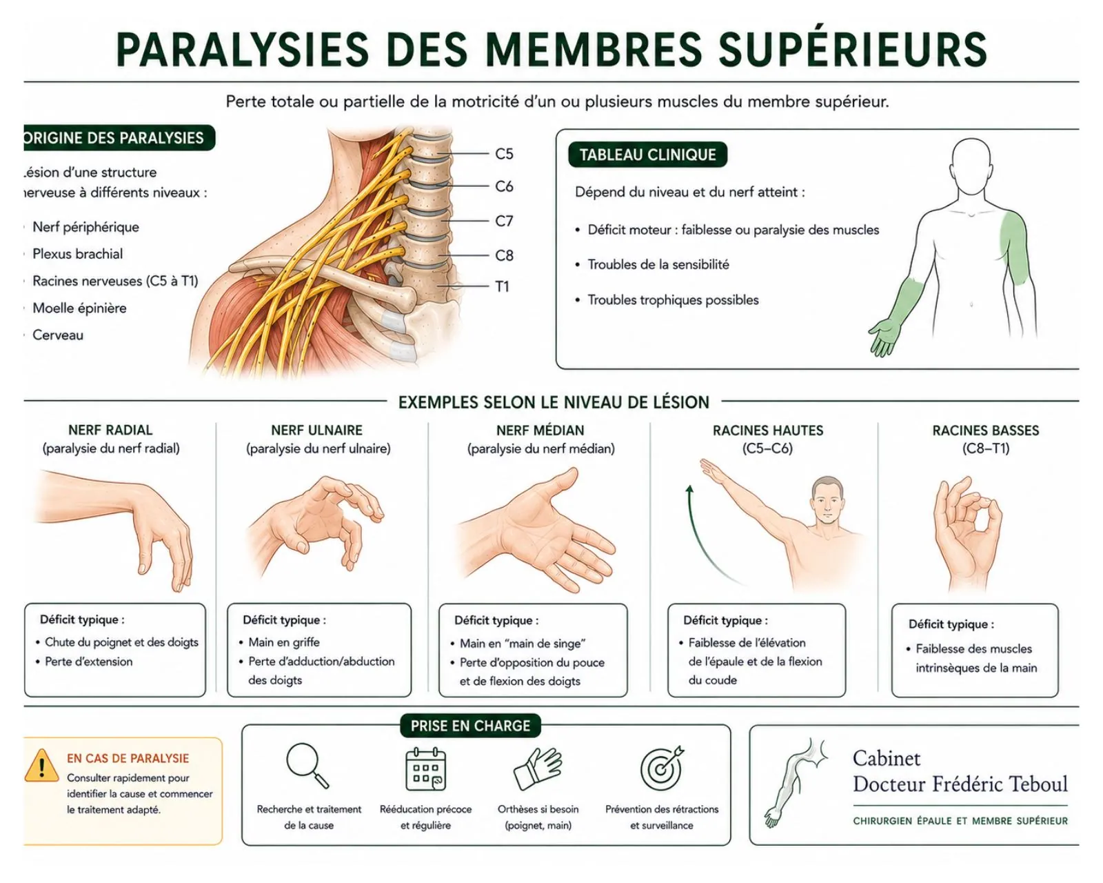 Paralysies du membre supérieur : origines de la lésion nerveuse, tableau clinique et déficits typiques des nerfs radial, ulnaire et médian et des racines C5 à T1 — Dr Frédéric Teboul, chirurgien spécialiste de la main et du plexus brachial à Paris
